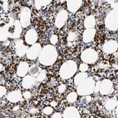 Anti-ANXA3 antibody produced in rabbit Prestige Antibodies&#174; Powered by Atlas Antibodies, affinity isolated antibody, buffered aqueous glycerol solution