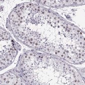 Anti-SGO1 antibody produced in rabbit Prestige Antibodies&#174; Powered by Atlas Antibodies, affinity isolated antibody