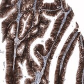 Anti-CD44 antibody produced in mouse Prestige Antibodies® Powered by Atlas Antibodies, clone CL13328, purified by using Protein A, buffered aqueous glycerol solution