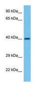 Anti-IL3RA (C-terminal) antibody produced in rabbit affinity isolated antibody