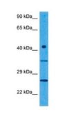 Anti-DULLARD antibody produced in rabbit affinity isolated antibody