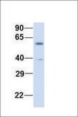 Anti-ZBTB7A antibody produced in rabbit affinity isolated antibody