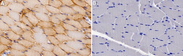 Anti-Caveolin-3 Antibody, clone 1L10 ZooMAb&#174; Rabbit Monoclonal recombinant, expressed in HEK 293 cells