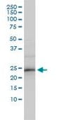 Monoclonal Anti-ZNF313 antibody produced in mouse clone 4G3-1A10, purified immunoglobulin, buffered aqueous solution