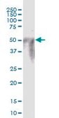 Anti-POTEA antibody produced in mouse purified immunoglobulin