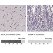 Anti-BEND6 antibody produced in rabbit Prestige Antibodies® Powered by Atlas Antibodies, affinity isolated antibody, buffered aqueous glycerol solution