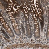 Anti-COMMD9 antibody produced in rabbit Prestige Antibodies&#174; Powered by Atlas Antibodies, affinity isolated antibody, buffered aqueous glycerol solution