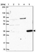 Anti-CLN6 antibody produced in rabbit Prestige Antibodies&#174; Powered by Atlas Antibodies, affinity isolated antibody, buffered aqueous glycerol solution