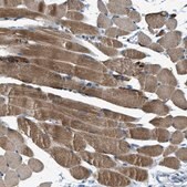Anti-SLC25A11 antibody produced in rabbit Prestige Antibodies&#174; Powered by Atlas Antibodies, affinity isolated antibody, buffered aqueous glycerol solution