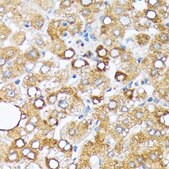 Anti-Cytochrome P450 4A (CYP4A11) Antibody, clone 10D10W7, Rabbit Monoclonal