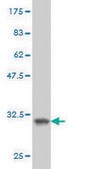 Monoclonal Anti-SH3GL2 antibody produced in mouse clone 5A6, purified immunoglobulin, buffered aqueous solution