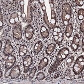 Anti-CHMP7 antibody produced in rabbit Prestige Antibodies&#174; Powered by Atlas Antibodies, affinity isolated antibody, buffered aqueous glycerol solution