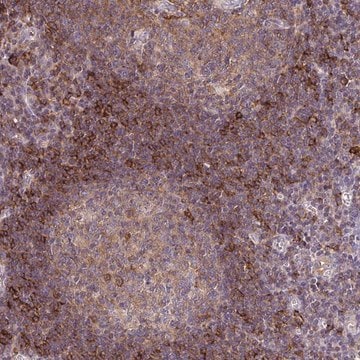 Anti-SLC9A9 antibody produced in rabbit Prestige Antibodies&#174; Powered by Atlas Antibodies, affinity isolated antibody, buffered aqueous glycerol solution