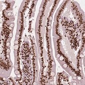 Monoclonal Anti-CTCF antibody produced in mouse Prestige Antibodies&#174; Powered by Atlas Antibodies, clone CL0307, purified immunoglobulin, buffered aqueous glycerol solution