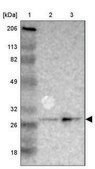 Anti-SDHB antibody produced in rabbit Ab1, Prestige Antibodies® Powered by Atlas Antibodies, affinity isolated antibody, buffered aqueous glycerol solution
