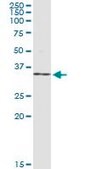 Monoclonal Anti-NR0B2 antibody produced in mouse clone 1A11, purified immunoglobulin, buffered aqueous solution