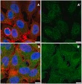 Anti-Caspase 3 Antibody, active (cleaved) form Chemicon®, from rabbit