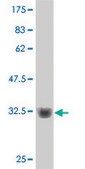ANTI-CHUK antibody produced in mouse clone 4D11, purified immunoglobulin, buffered aqueous solution