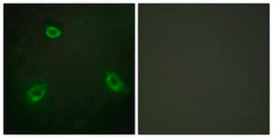 Anti-TM16G antibody produced in rabbit affinity isolated antibody