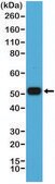 Anti-MUM1/IRF4 antibody, Rabbit monoclonal recombinant, expressed in HEK 293 cells, clone RM352, purified immunoglobulin