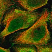 Anti-BEND6 antibody produced in rabbit Prestige Antibodies® Powered by Atlas Antibodies, affinity isolated antibody