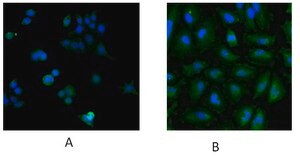 Anti-UBE2L3 antibody produced in goat affinity isolated antibody, buffered aqueous solution