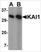 Anti-KAI1 antibody produced in rabbit affinity isolated antibody, buffered aqueous solution