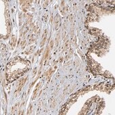 Anti-RNF122 antibody produced in rabbit Prestige Antibodies&#174; Powered by Atlas Antibodies, affinity isolated antibody, buffered aqueous glycerol solution