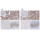 Anti-MCCC2 antibody produced in rabbit Prestige Antibodies® Powered by Atlas Antibodies, affinity isolated antibody, buffered aqueous glycerol solution
