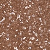 Anti-ADD2 antibody produced in rabbit Prestige Antibodies&#174; Powered by Atlas Antibodies, affinity isolated antibody, buffered aqueous glycerol solution