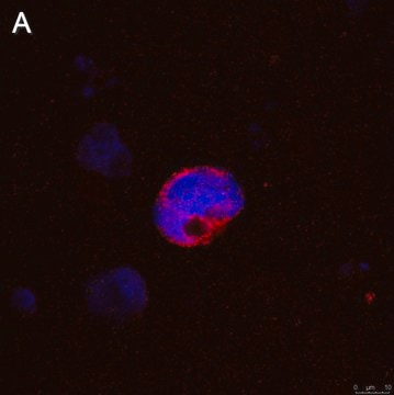 Anti-IFN&#947; Antibody, clone 5K15 ZooMAb&#174; Rabbit Monoclonal recombinant, expressed in HEK 293 cells