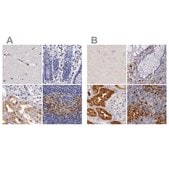 Anti-RENBP antibody produced in rabbit Ab1, Prestige Antibodies&#174; Powered by Atlas Antibodies, affinity isolated antibody, buffered aqueous glycerol solution