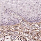 Monoclonal Anti-FBN1 antibody produced in mouse Prestige Antibodies&#174; Powered by Atlas Antibodies, clone CL0225, purified immunoglobulin, buffered aqueous glycerol solution