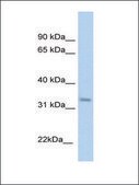 Anti-KHK antibody produced in rabbit affinity isolated antibody
