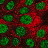 Anti-DCAF4 antibody produced in rabbit Prestige Antibodies&#174; Powered by Atlas Antibodies, affinity isolated antibody, buffered aqueous glycerol solution