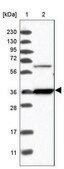 Anti-NMBR antibody produced in rabbit Prestige Antibodies&#174; Powered by Atlas Antibodies, affinity isolated antibody, buffered aqueous glycerol solution