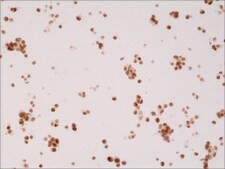 Anti-AR (n-terminal) antibody, Rabbit monoclonal recombinant, expressed in HEK 293 cells, clone RM254, purified immunoglobulin