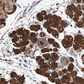 Anti-TPD52L1 antibody produced in rabbit Prestige Antibodies&#174; Powered by Atlas Antibodies, affinity isolated antibody, buffered aqueous glycerol solution, ab2