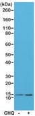 Anti-LC3B antibody, Rabbit Monoclonal recombinant, expressed in HEK 293 cells, clone RM293, purified immunoglobulin