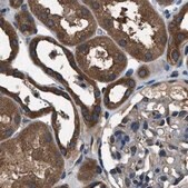 Anti-ARFGAP2 antibody produced in rabbit Prestige Antibodies&#174; Powered by Atlas Antibodies, affinity isolated antibody, buffered aqueous glycerol solution