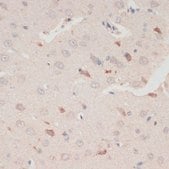 Anti-Phospho-GSK3B-S9 antibody produced in rabbit