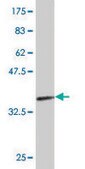 Monoclonal Anti-AGT antibody produced in mouse clone 1A10, purified immunoglobulin, buffered aqueous solution