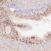 Anti-EMX2 antibody produced in rabbit Prestige Antibodies® Powered by Atlas Antibodies, affinity isolated antibody, buffered aqueous glycerol solution