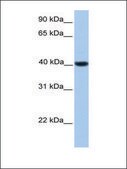 Anti-NR2F2 antibody produced in rabbit affinity isolated antibody