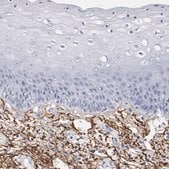Anti-EMILIN1 antibody produced in rabbit Prestige Antibodies&#174; Powered by Atlas Antibodies, affinity isolated antibody, buffered aqueous glycerol solution
