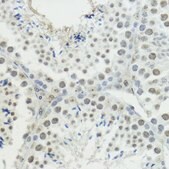 Anti-Phospho-Histone H3-T45 antibody produced in rabbit