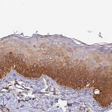 Anti-SLC39A13 antibody produced in rabbit Prestige Antibodies&#174; Powered by Atlas Antibodies, affinity isolated antibody, buffered aqueous glycerol solution
