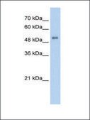 Anti-ALAS2 antibody produced in rabbit IgG fraction of antiserum