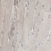 Anti-SYVN1 antibody produced in rabbit Prestige Antibodies&#174; Powered by Atlas Antibodies, affinity isolated antibody, buffered aqueous glycerol solution