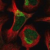Anti-GSE1 antibody produced in rabbit Prestige Antibodies® Powered by Atlas Antibodies, affinity isolated antibody, buffered aqueous glycerol solution